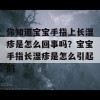 你知道宝宝手指上长湿疹是怎么回事吗？宝宝手指长湿疹是怎么引起的

