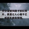 乔任梁被掏肠子脱肛照片，真是让人心痛不已，感到无奈和惋惜。